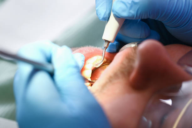 Best Emergency Treatment for Oral Infections in South Wenatchee, WA