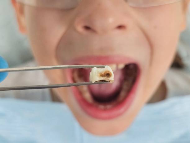 Best Weekend Emergency Dental Services in South Wenatchee, WA